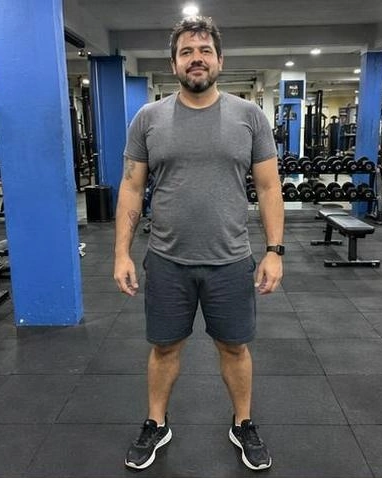 Comparação 01, antes: pessoa fictícia em imagem gerada por IA, não resultado real