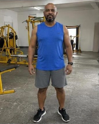 Comparação 03, antes: pessoa fictícia em imagem gerada por IA, não resultado real