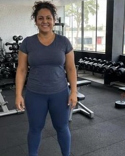 Comparação 04, depois: pessoa fictícia em imagem gerada por IA, não resultado real